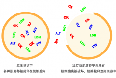 进行性肌营养不良如何诊断？